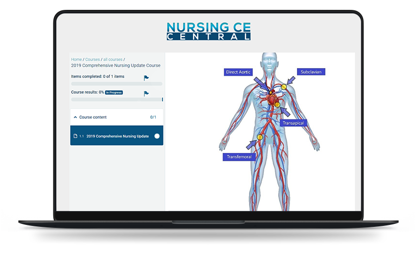 Laptop showing Nursing CE course