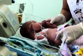 Neonatal Abstinence Syndrome